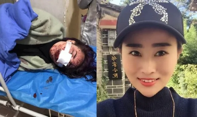 東北女子在麗江遭暴打，事發已經兩個多月了，至今案件沒有任何進展。（網絡圖片）