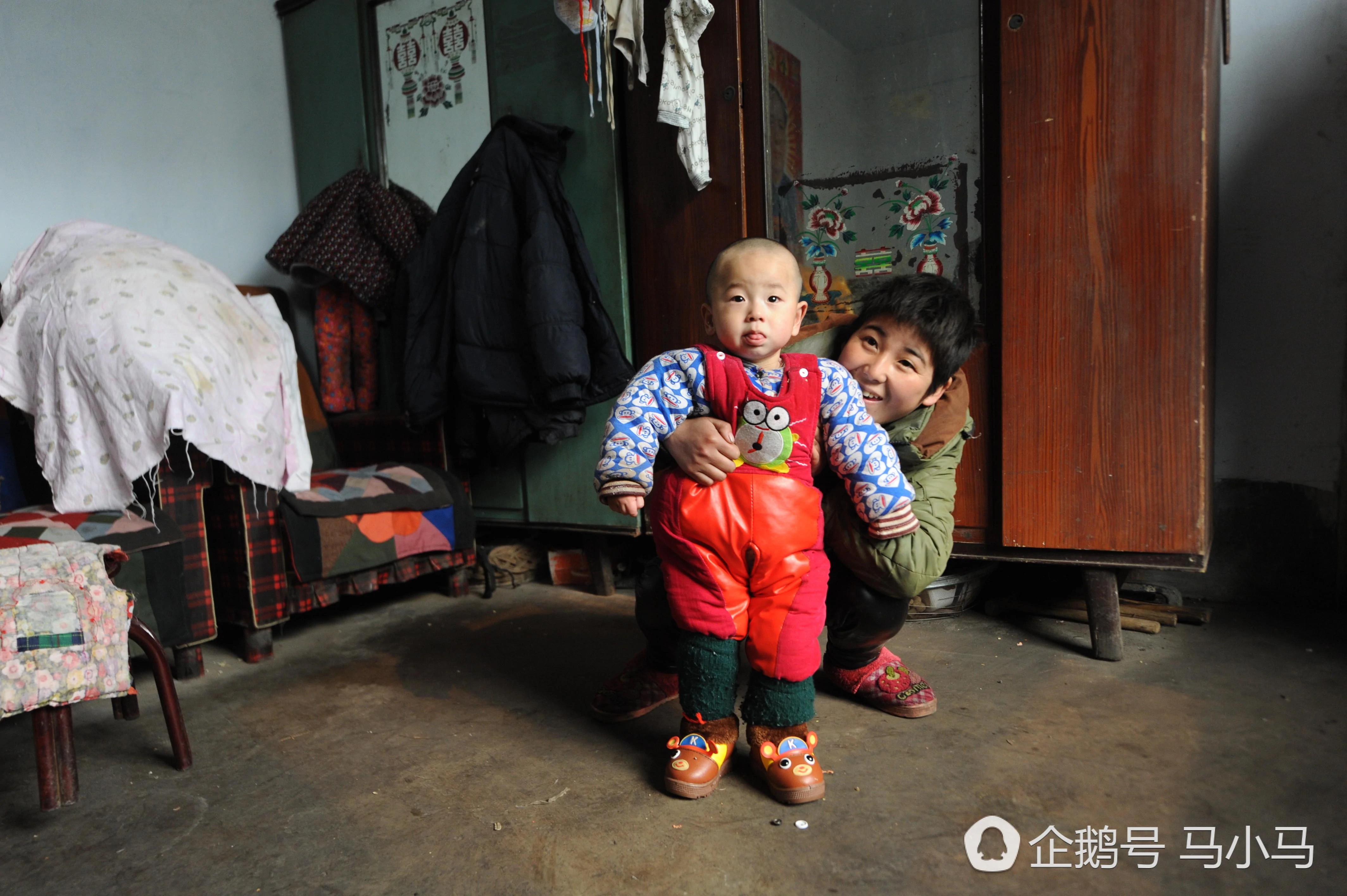 山西这孩子生来没肛门 竟然现在已经三岁了