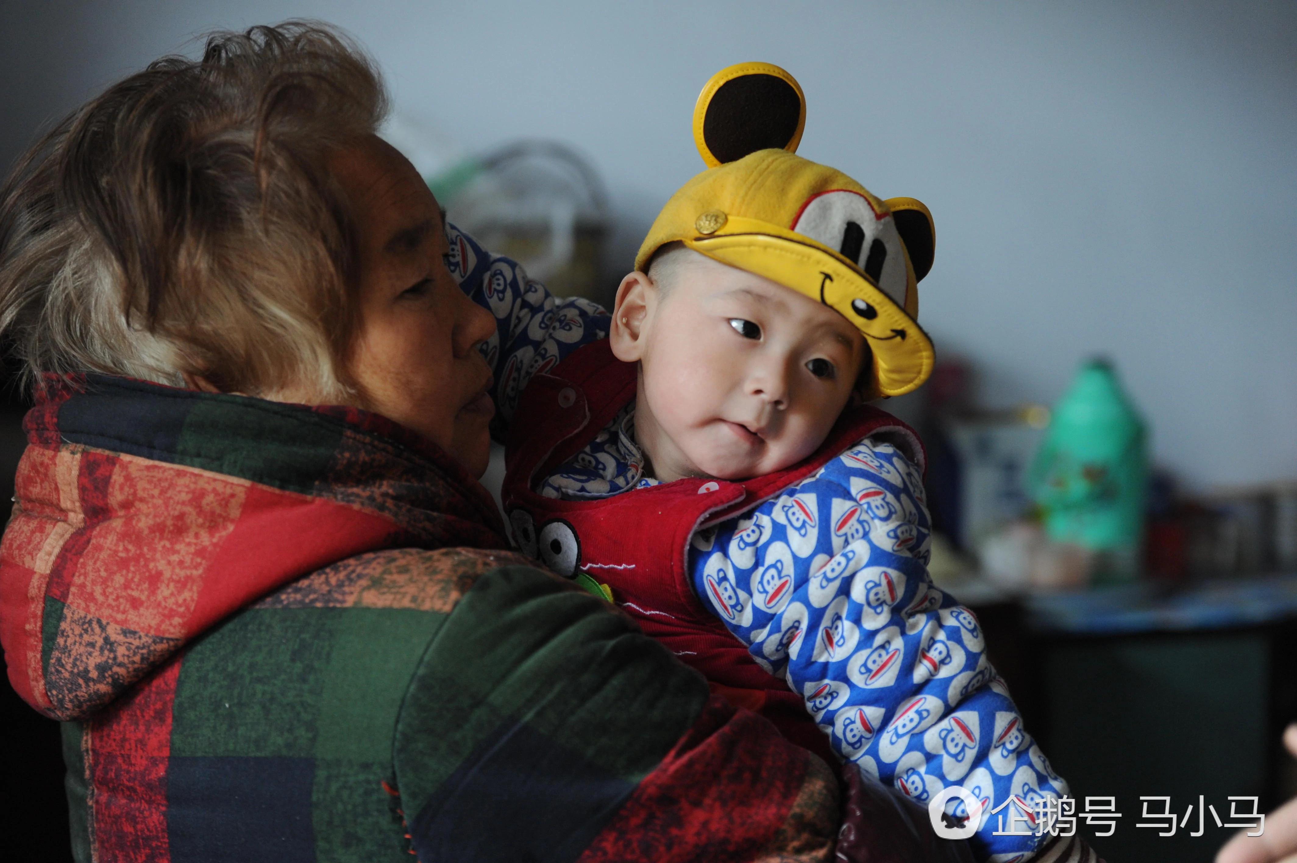 山西这孩子生来没肛门 竟然现在已经三岁了