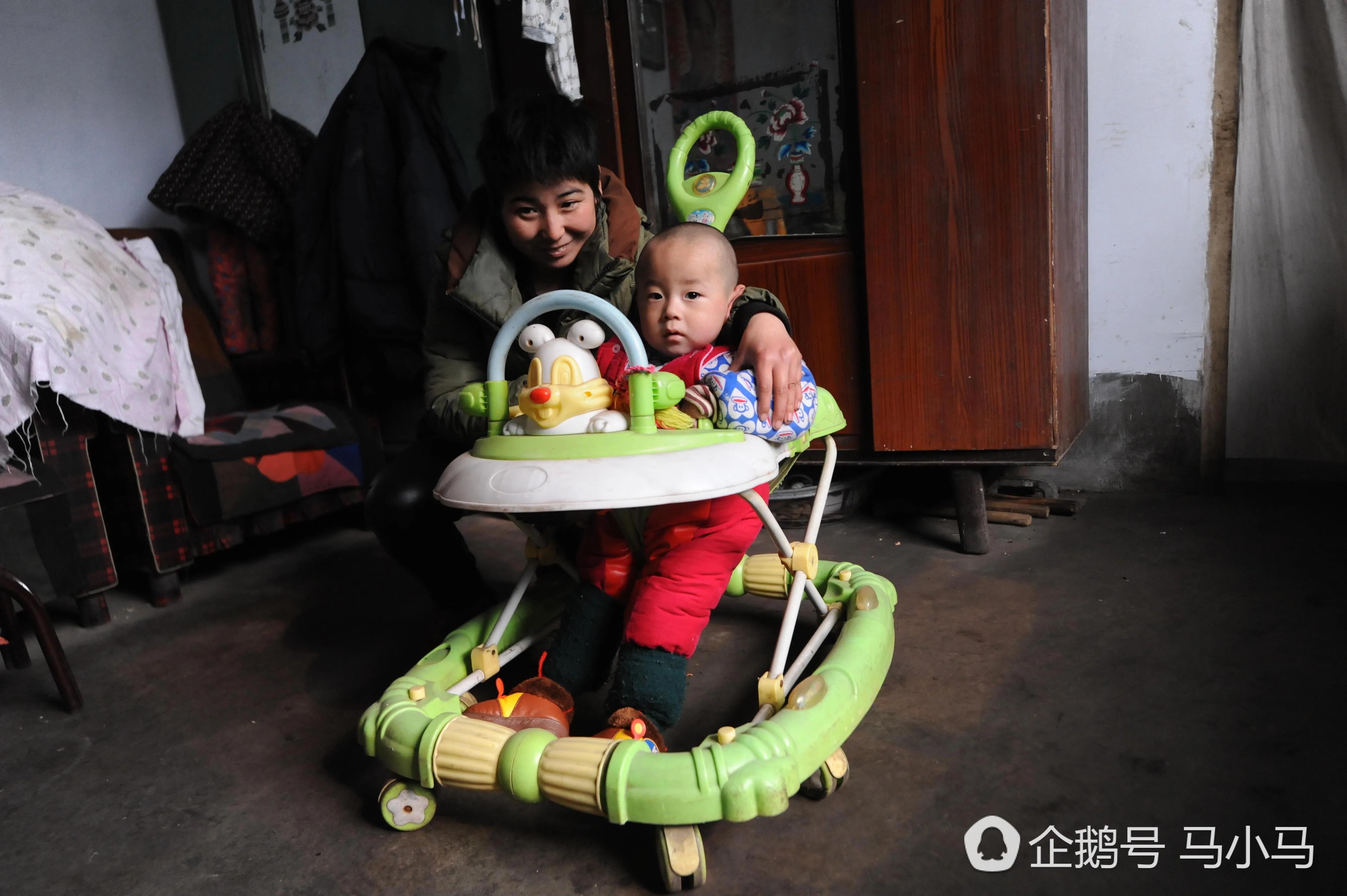 山西这孩子生来没肛门 竟然现在已经三岁了