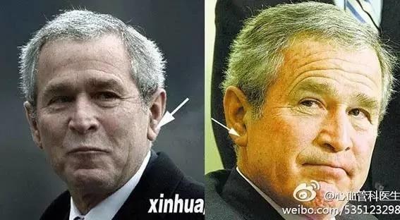 医生忘了告诉你 身体出现这些小变化时 你要加倍小心!