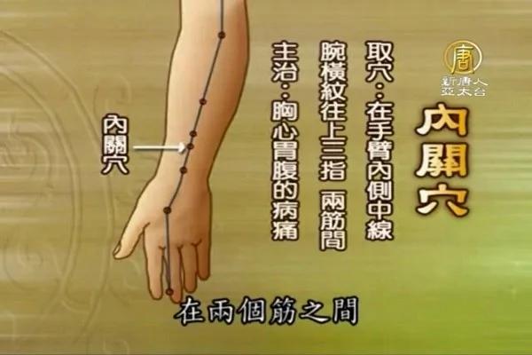 心律不整别“乱补” 心悸可按“内关穴”缓解
