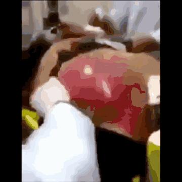 男子一天内喝了25罐红牛 脱下衣服后所有的护士都惊呆了!