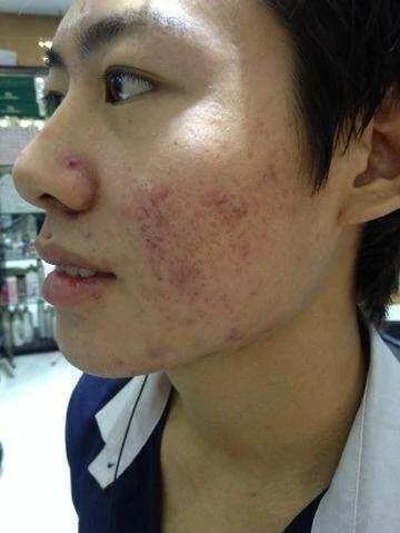 肝脏是否健康 看你的脸就知道