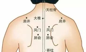 不吃消炎药打点滴 用简单易行的中医疗法治好了孩子的感冒