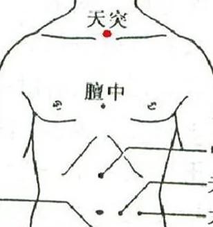 不吃消炎药打点滴 用简单易行的中医疗法治好了孩子的感冒