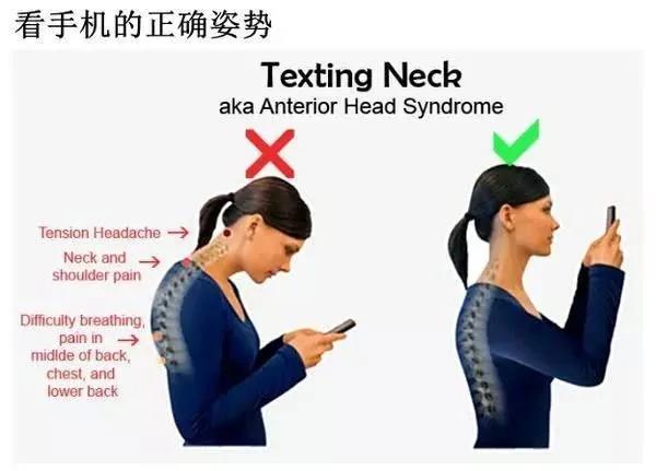 你可能每天都在谋杀颈椎!拯救它从“抬头”做起