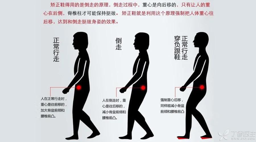 倒走锻炼 是好是坏?