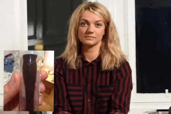 英女赴越南游玩鼻子变得怪怪的… 医生:再晚一点 大脑会被吃掉!