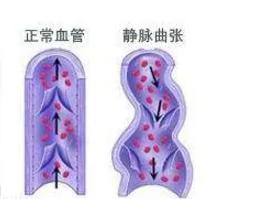 人在生气的时候为什么会青筋暴起?