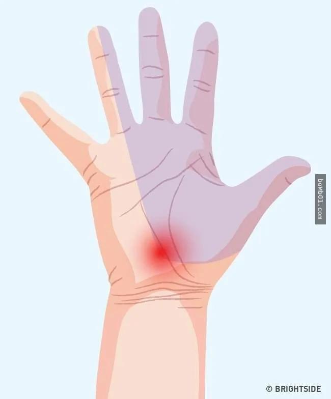 7种“手痛的感觉”代表身体已经在发出健康警讯