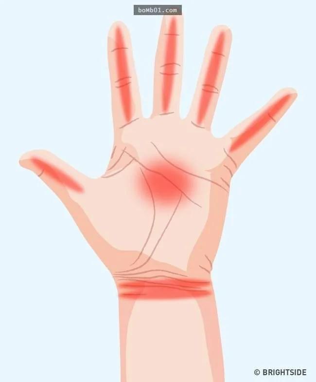 7种“手痛的感觉”代表身体已经在发出健康警讯