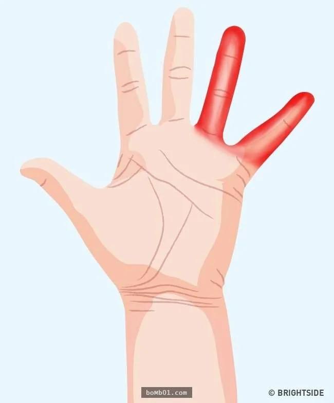 7种“手痛的感觉”代表身体已经在发出健康警讯