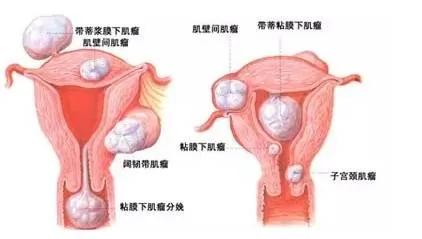 女性的这14个部位至关重要 千万要保护好 做个美丽健康的女人!