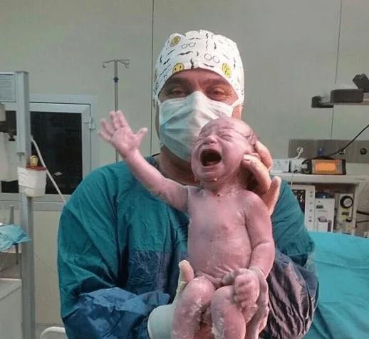 刚剖腹婴儿手抓住医生的剪刀不让剪脐带