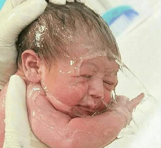 刚剖腹婴儿手抓住医生的剪刀不让剪脐带