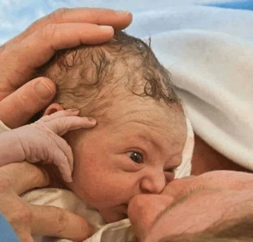 刚剖腹婴儿手抓住医生的剪刀不让剪脐带