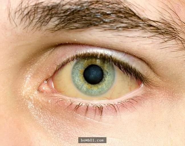 如果你的眼睛现在“看到这样子的画面”代表健康有问题