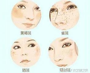 肝不说话 却主宰着你脸上的斑