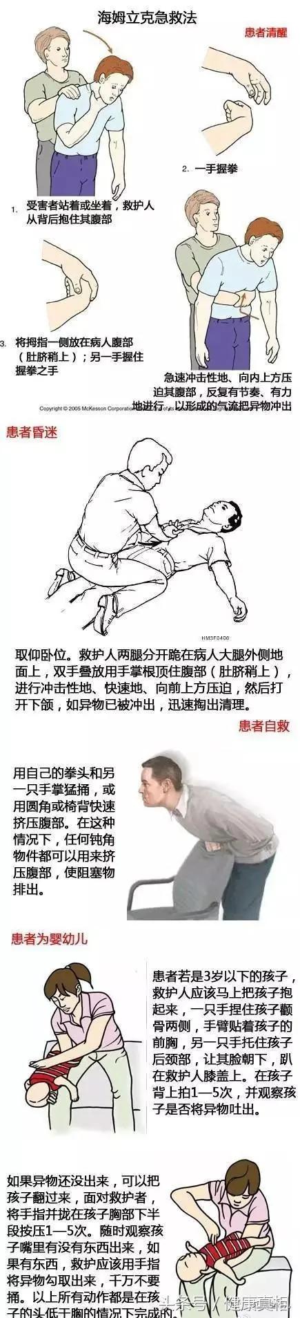 2岁女孩吃饭被噎死 救命方法却如此简单