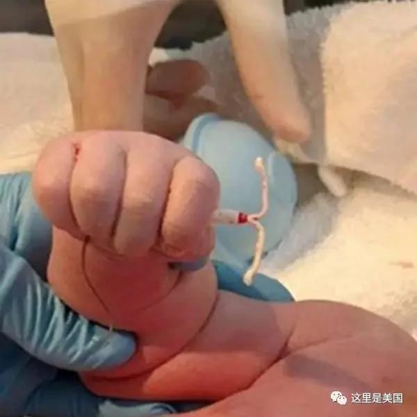一张照片脸书转发超70000次 只因宝宝出生时手里拽着这个…