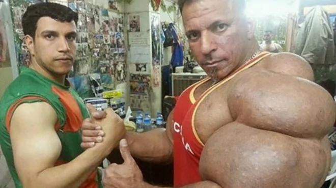 世界上最恐怖的肌肉男 没有脖子 像是怪兽 把人吓死
