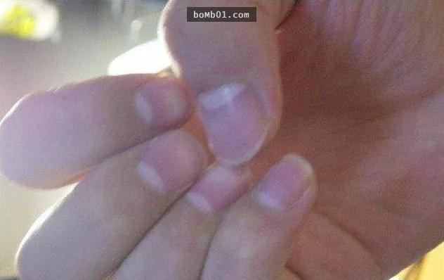 如果你发现指甲上的“月牙”面积慢慢变少 那就代表“早衰”