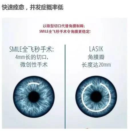 每三人就有一人是近视眼!一个办法不只让你看得清