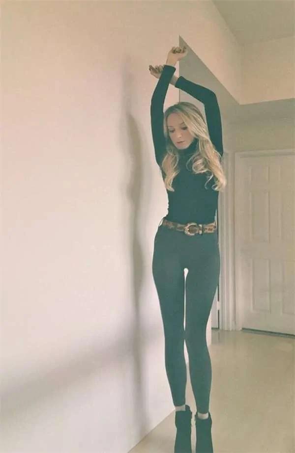 红色胎记让她过敏 却是自己吃掉双胞胎妹妹的铁证