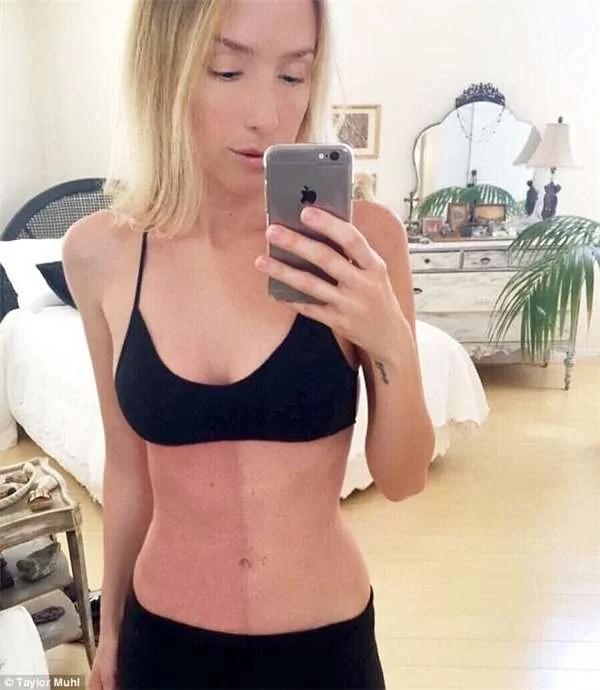 红色胎记让她过敏 却是自己吃掉双胞胎妹妹的铁证