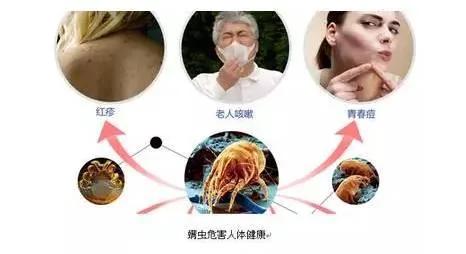 夏天到了 凉席上的螨虫有多可怕?!没关系 “这一招”教你立马祛除