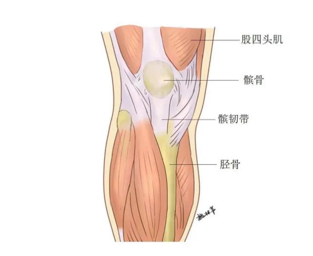 每天暴走两万步患滑膜炎?确实有可能 健身须谨慎
