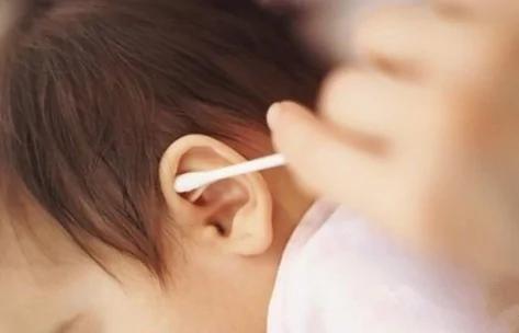 5岁男孩掏耳朵花了5000元 医生:硬得像水泥