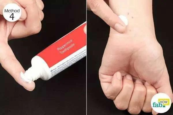 被蚊子咬后皮肤越抓越痒 教你个止痒绝招 只需10秒钟止痒不留印痕