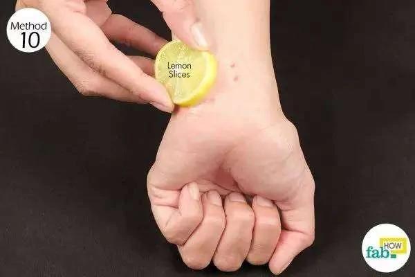 被蚊子咬后皮肤越抓越痒 教你个止痒绝招 只需10秒钟止痒不留印痕