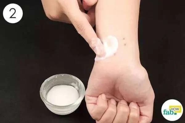 被蚊子咬后皮肤越抓越痒 教你个止痒绝招 只需10秒钟止痒不留印痕