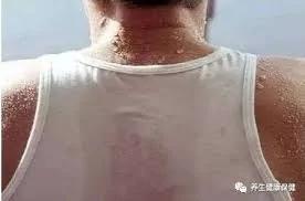 汗从哪里出 病从哪里来!夏天爱出汗的 快对照看看吧!