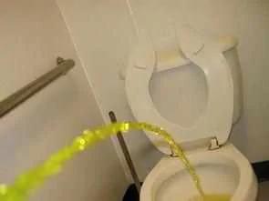 这样的小便要警惕 说明身体出问题了