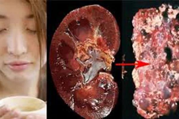喝茶之后就千万别吃“这个”!否则你的肾脏会坏光光的!