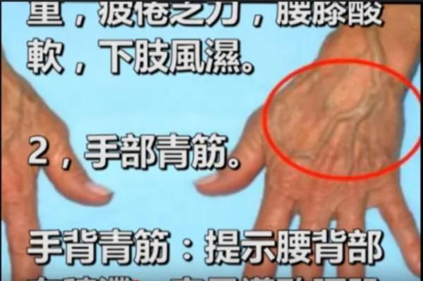 常说“青筋暴跳” 可你知道那些暴跳出来的青筋到底是什么吗?