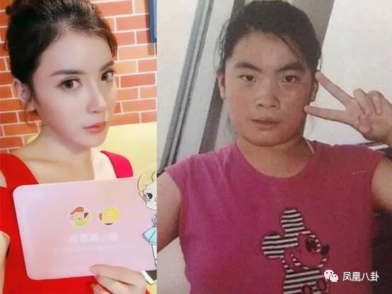她因长太丑遭校园暴力而自残 整容13次终成"赢家"