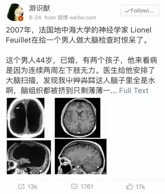 脑子进水真可怕!法男子脑积水30年 检查发现脑子没了