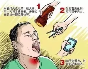 误吞一根鱼刺 杭州28岁妈妈抢救了7天，几乎全身换血人还是没了！