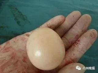 女婴带"玉"出生 医生:这东西全世界都极为罕见