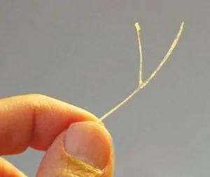 年轻辣妈吃饭误吞鱼刺 抢救了7天 结果