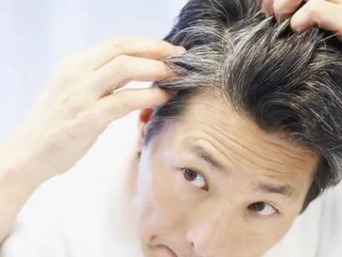 哪里长白发说明肾气不足