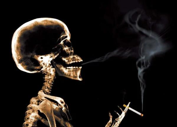每年4.5万加拿大人因它而死