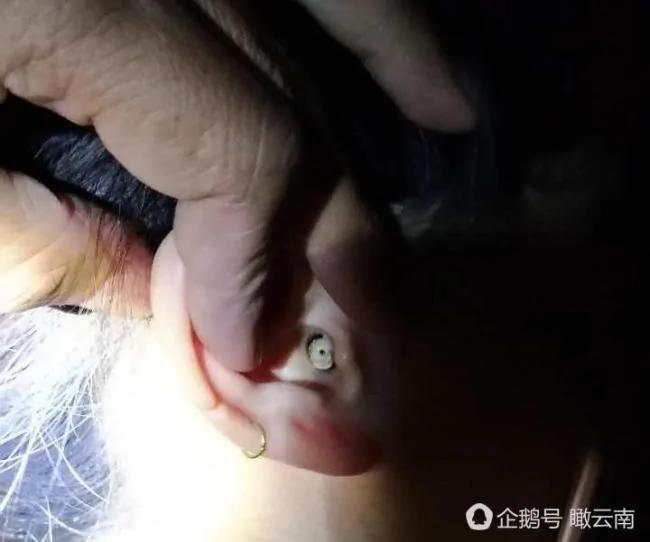 一姑娘游大理享受掏耳朵 竟掏出玉珠子