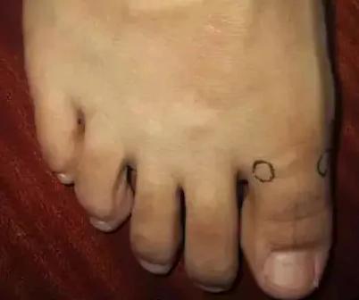 “上病取下 百病治足”一病一绝招