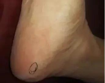 “上病取下 百病治足”一病一绝招